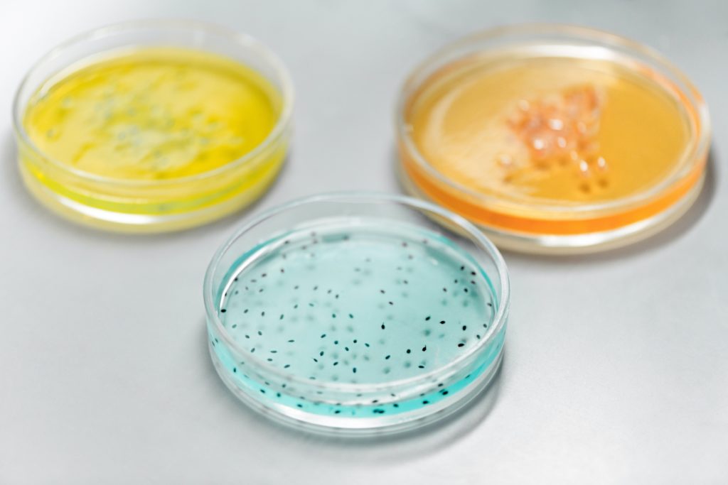 Les bienfaits des postbiotiques